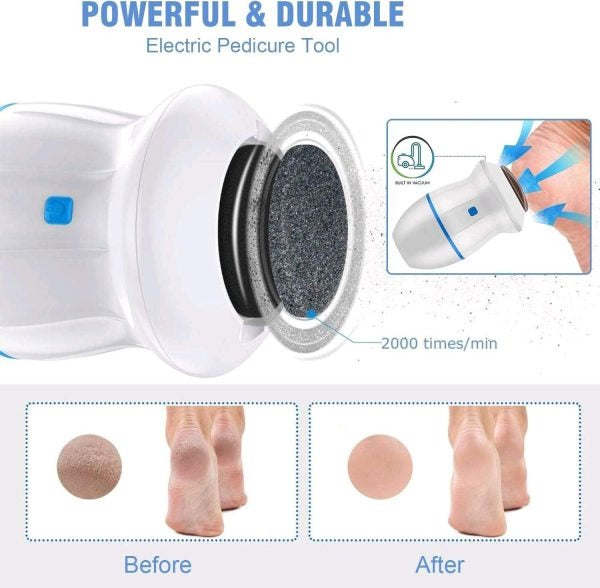 Electric Foot Callus Remover With Built-in Vacuum